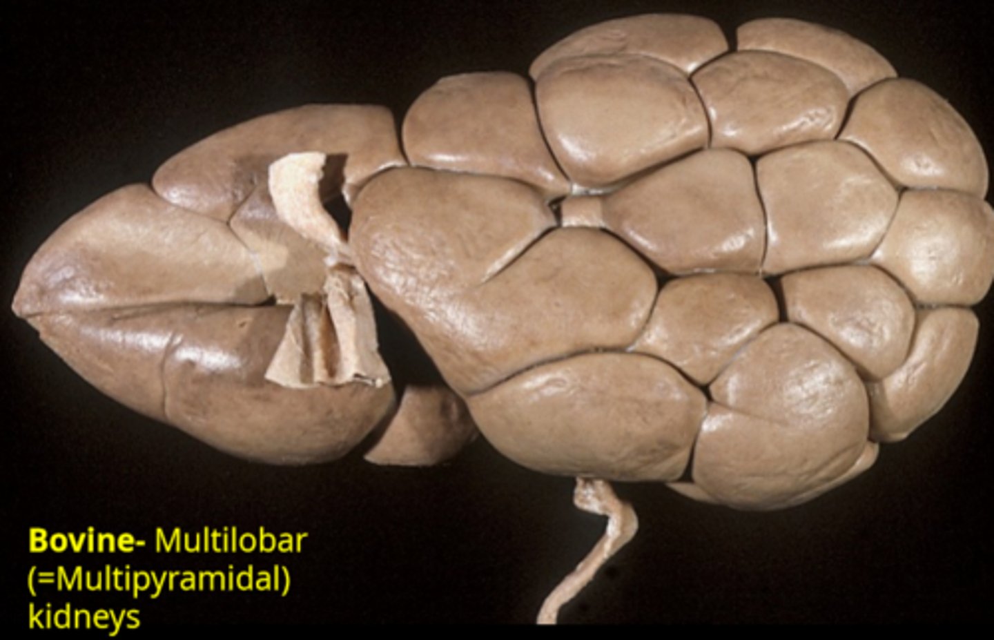 <p>multilobar (multipyramidal)</p>