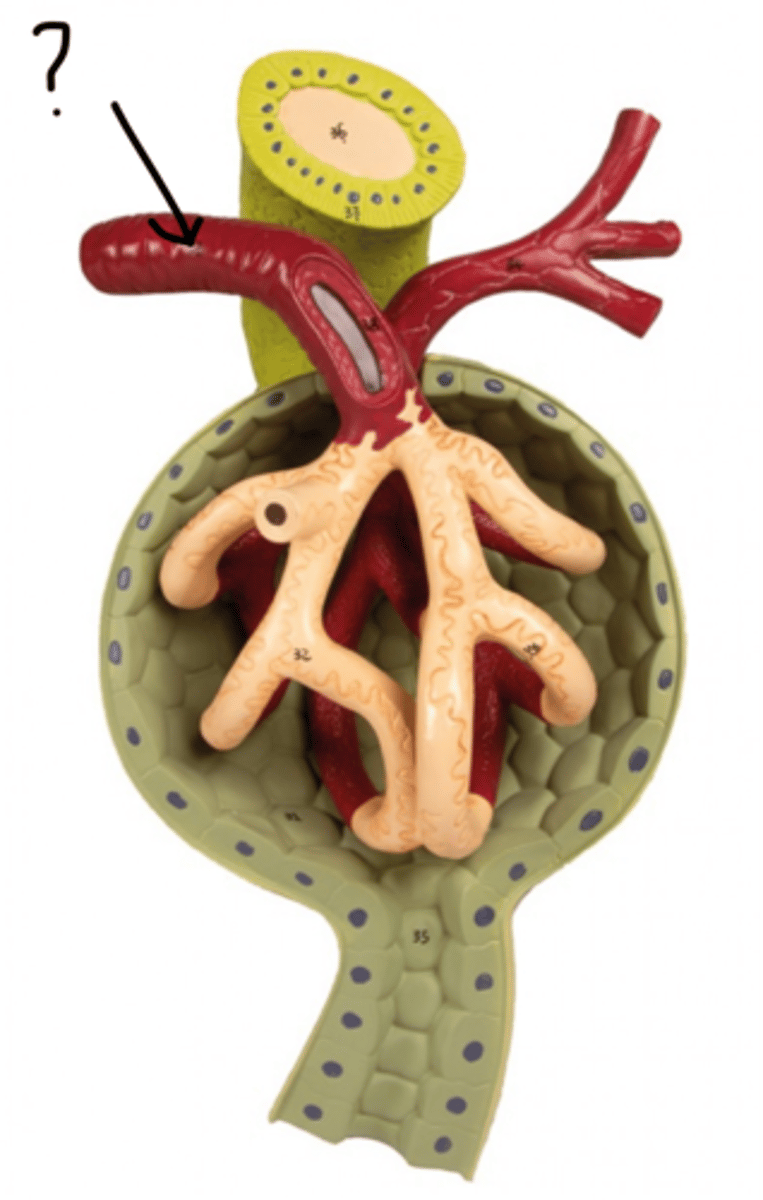 <p>Name this vessel</p>