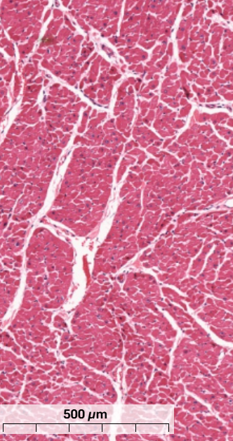 <p>What type of muscle is this and how do you know? (transverse section)</p>