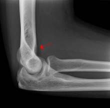 <p>What is shown by the arrow?</p>