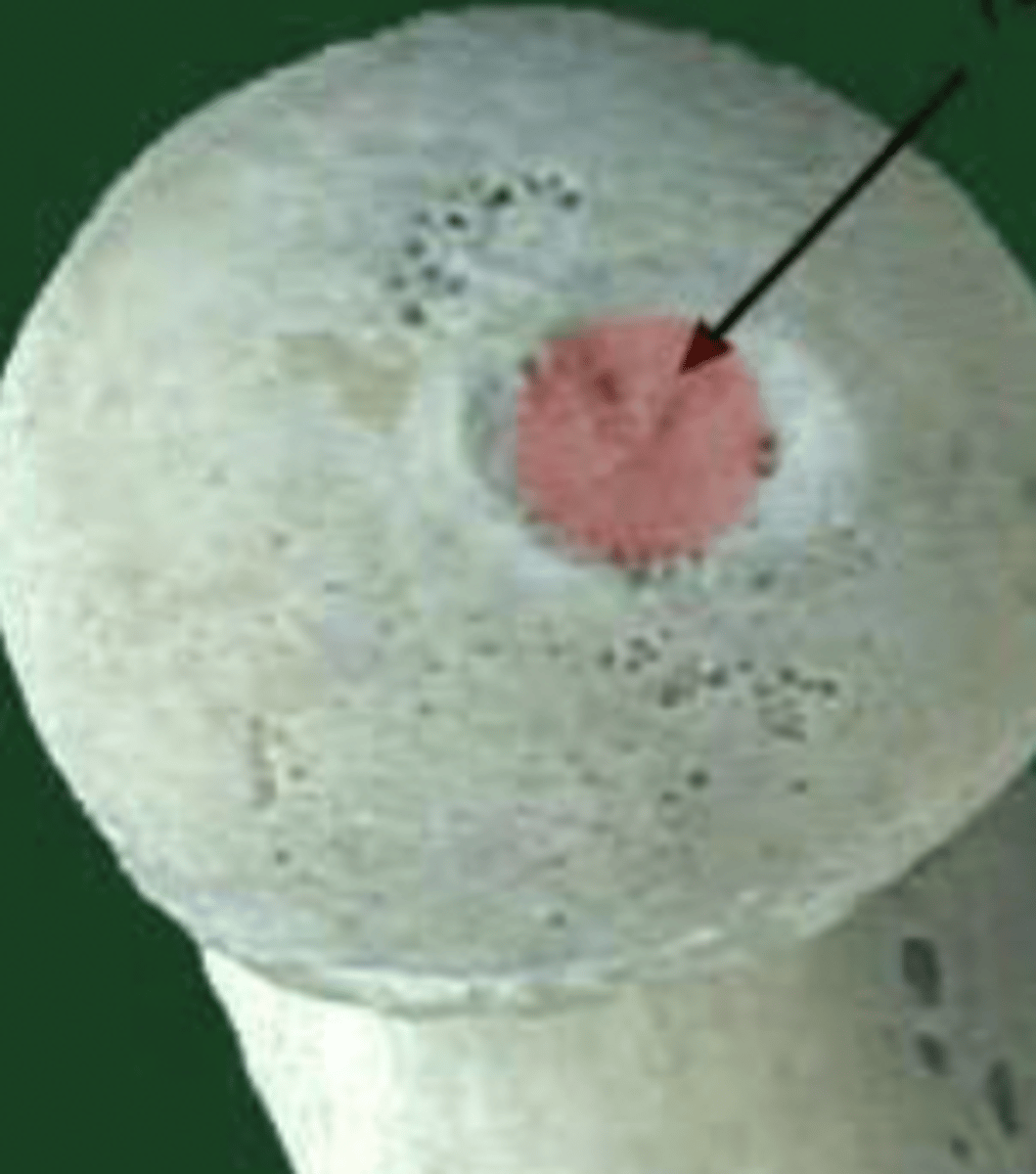<p>fovea capitis</p>