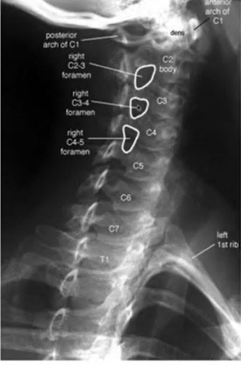 <p>(it says right but its really left)</p>