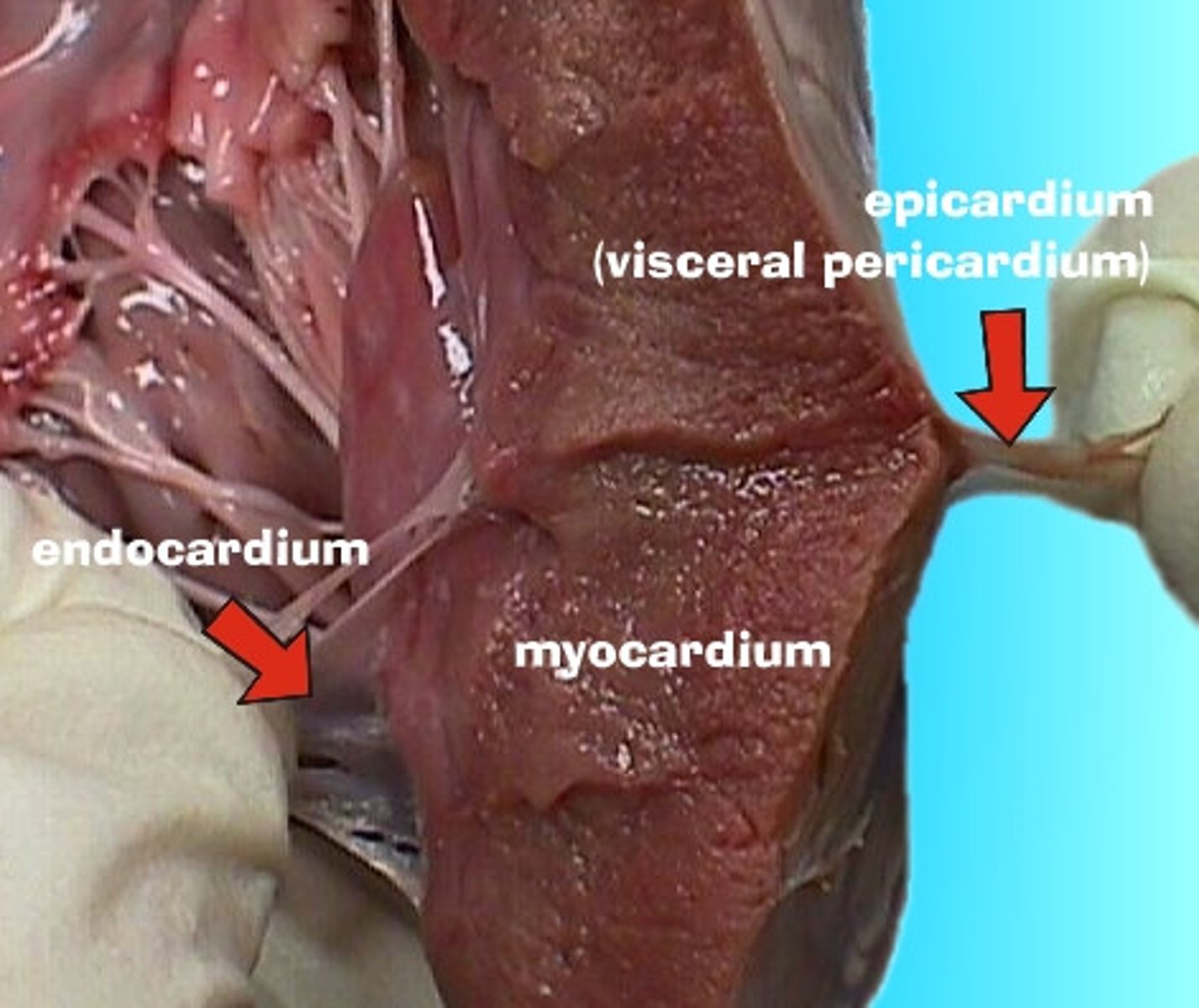 <p>epicardium</p>