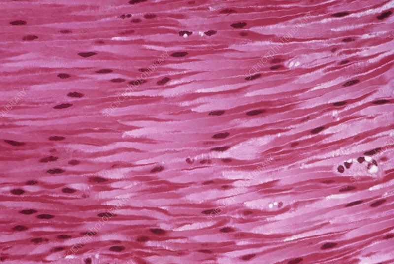 <p>Smooth Muscle Tissue</p>