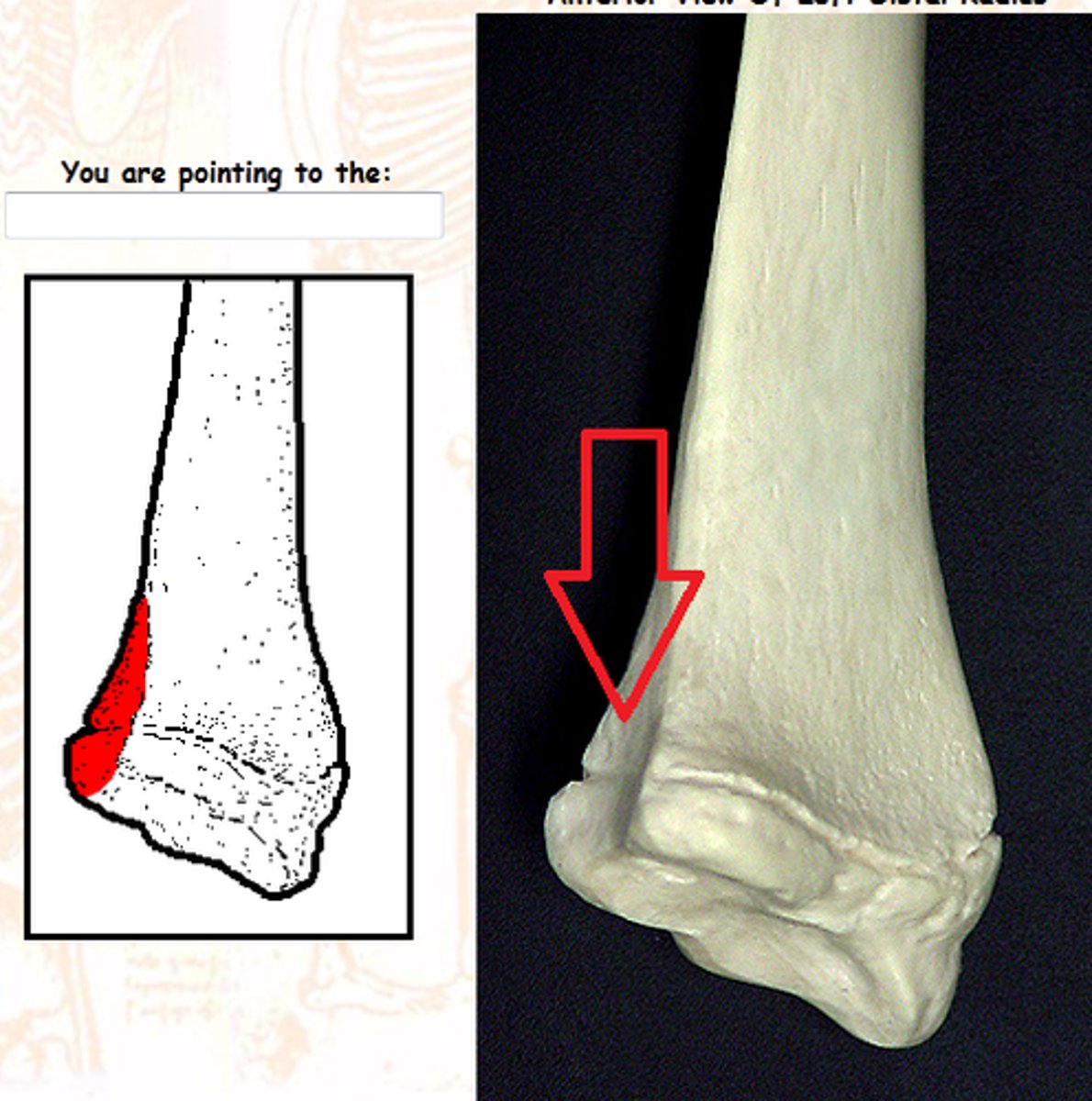 <p>Medial indentation on radius for ulna articulation.</p>