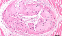 <p>identify</p>