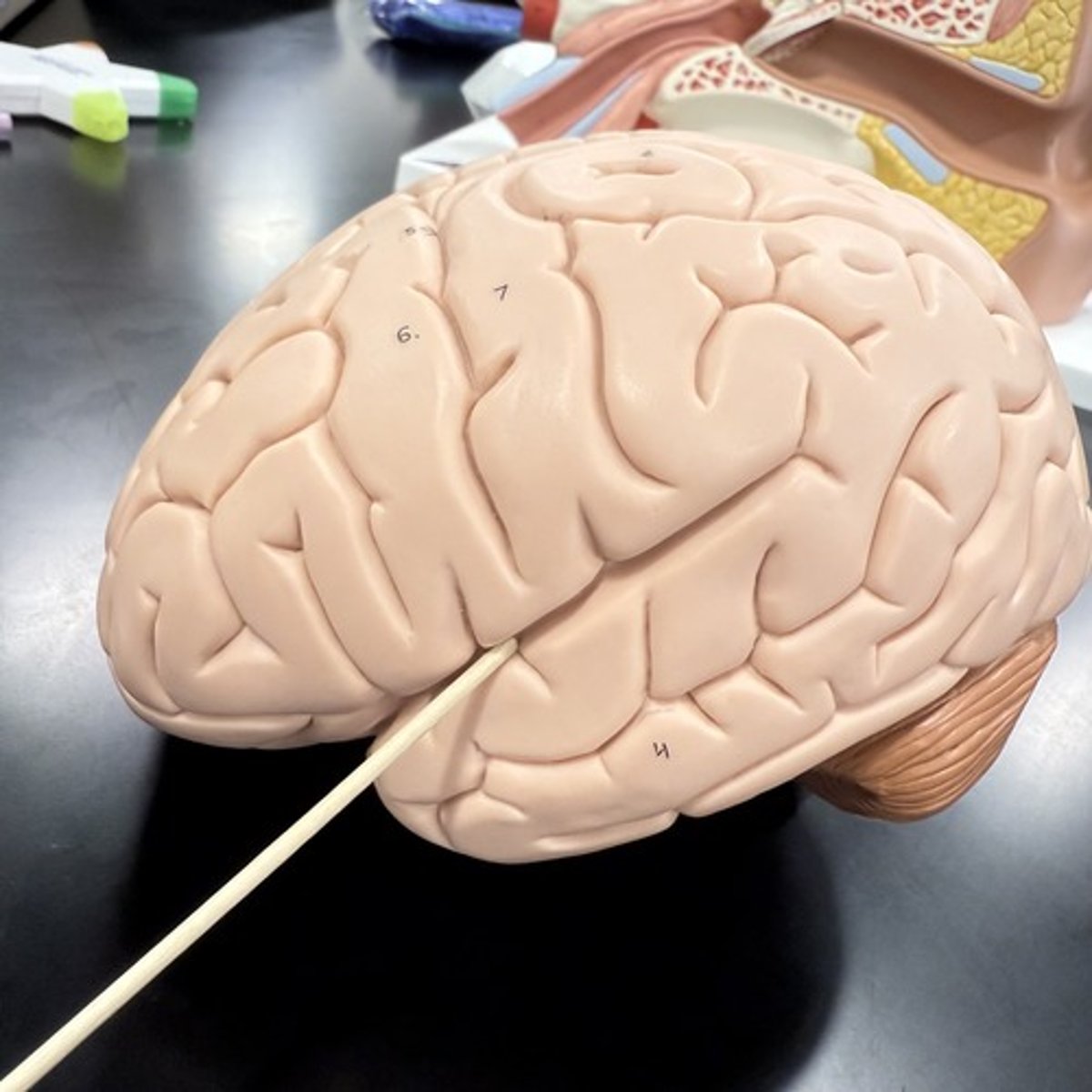 <p>What is this shallow groove?</p>