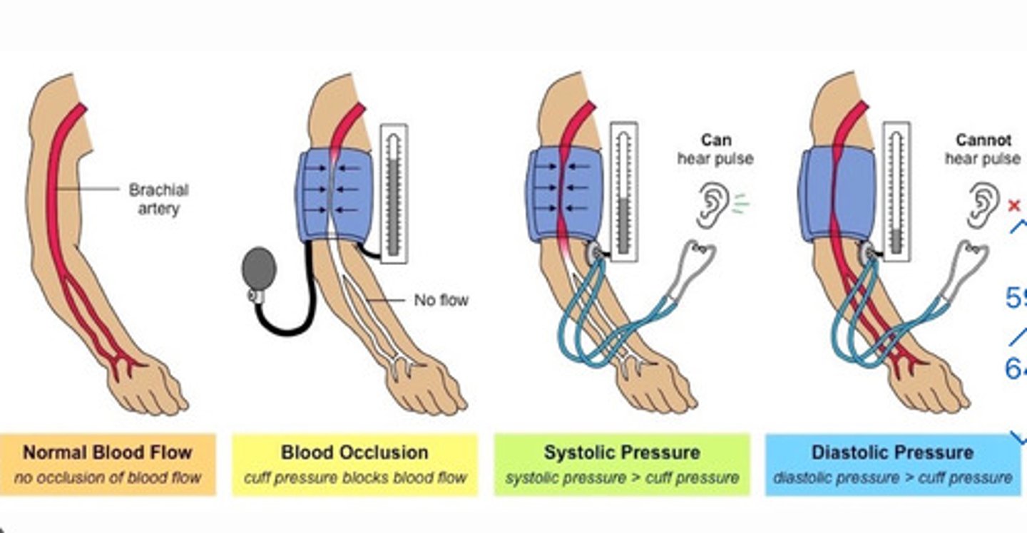 <p>a method of measuring blood pressure by listening for the appearance and disappearance of Korotkoff sounds within the body</p>