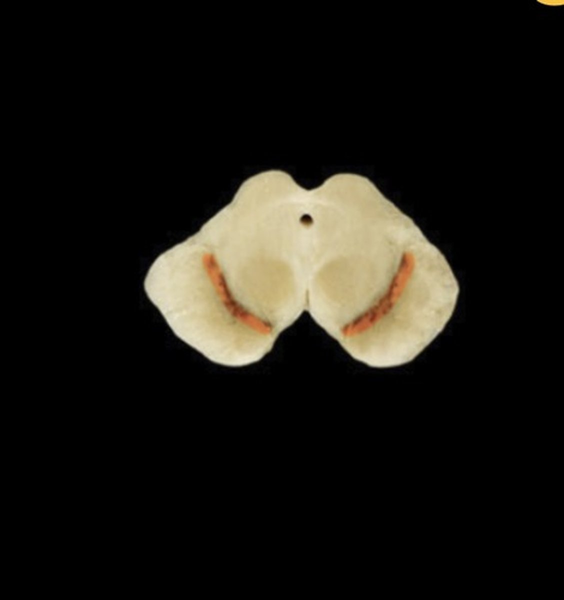 <p>Name this structure</p>