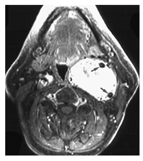 <p>What does the figure show?</p>