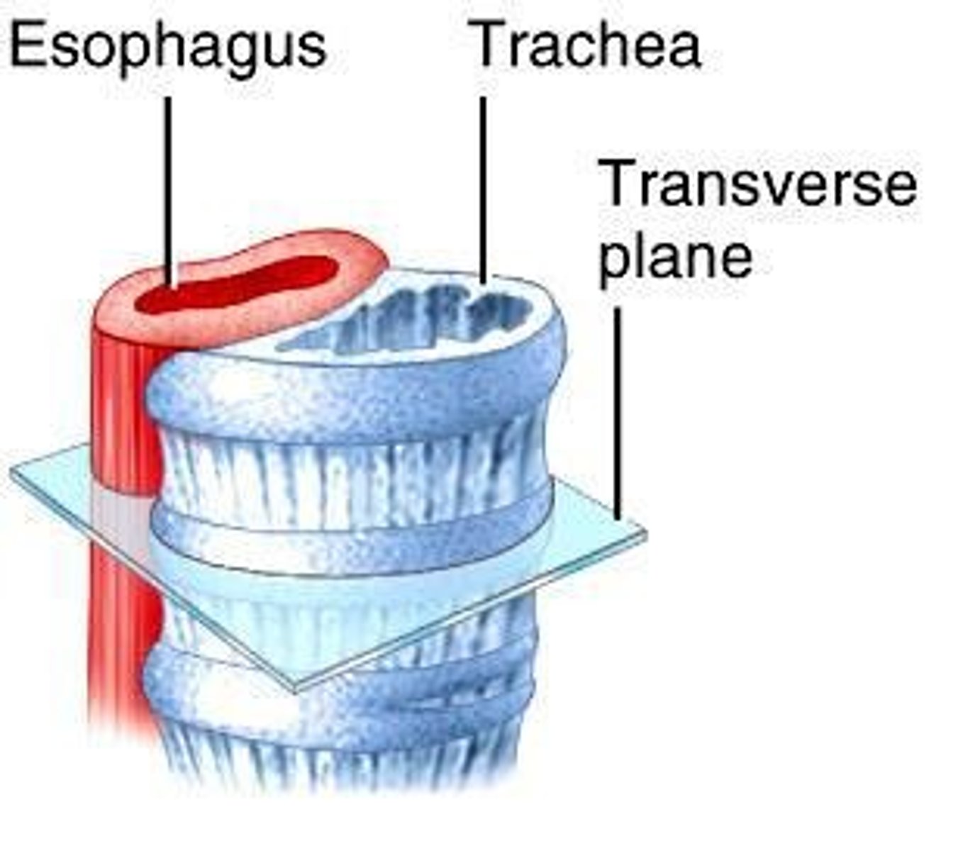 <p>Airway passage within the trachea.</p>