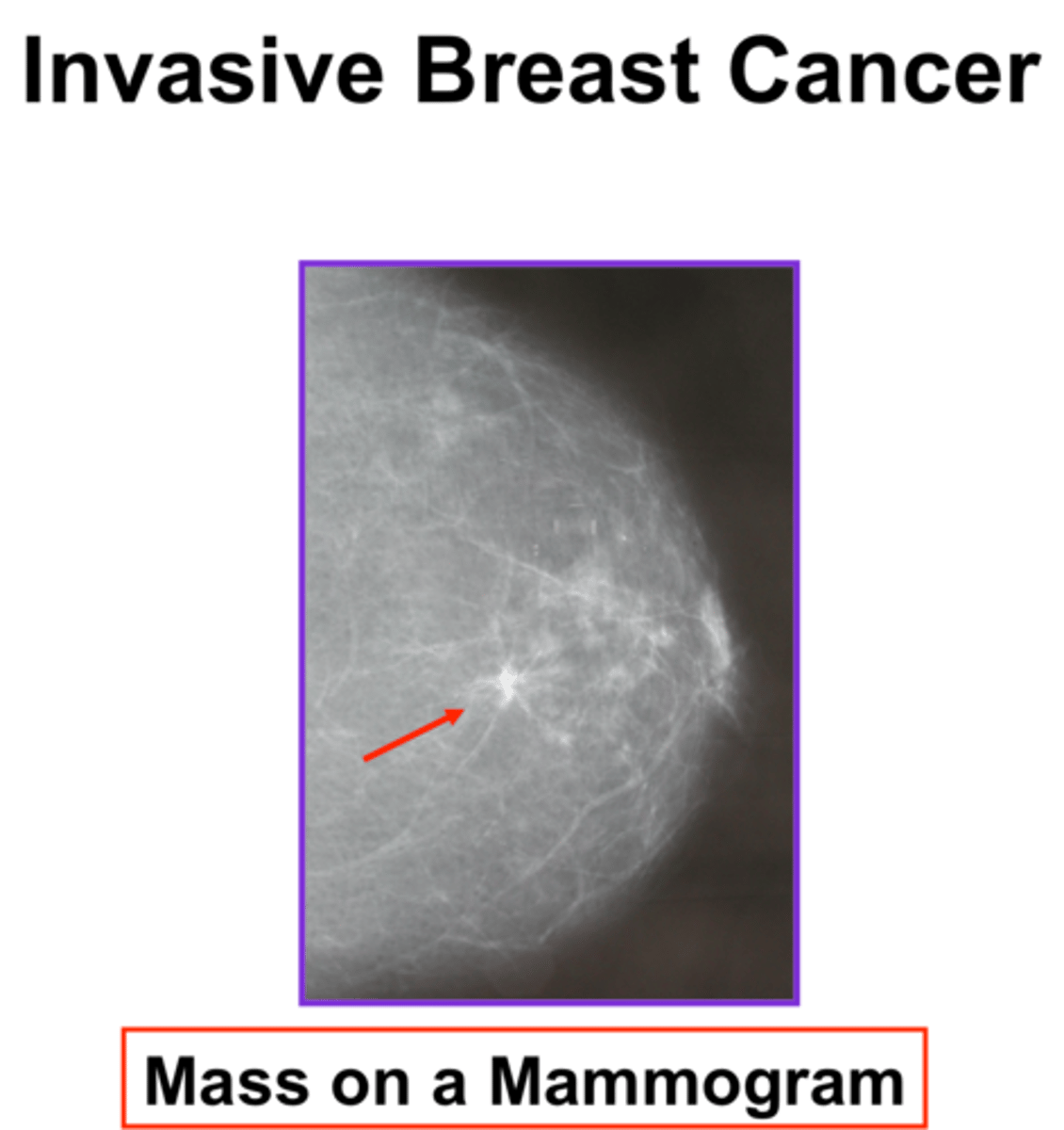 <p>x-ray film of the breast</p>