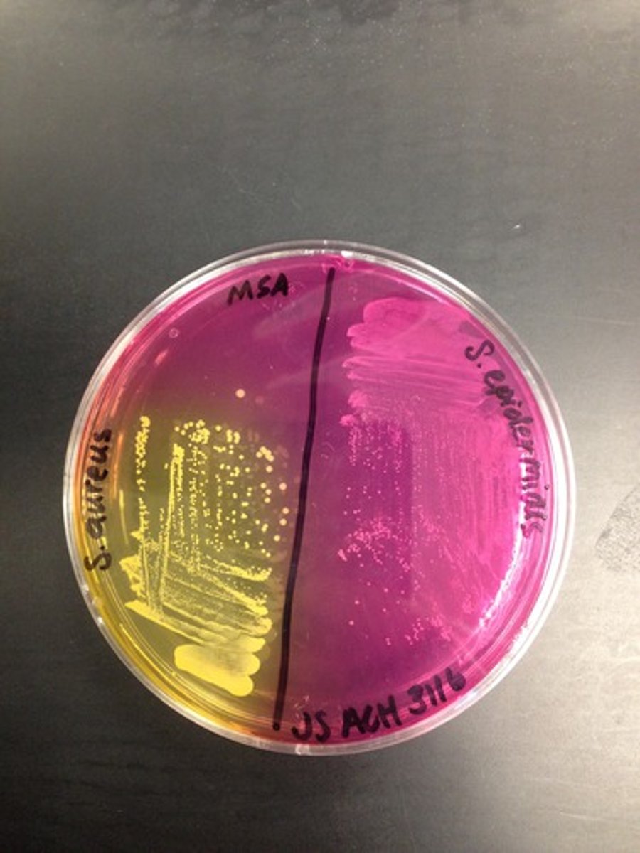 <p>In case of a mishap (like plate spillage) plate identity is still maintained.</p>