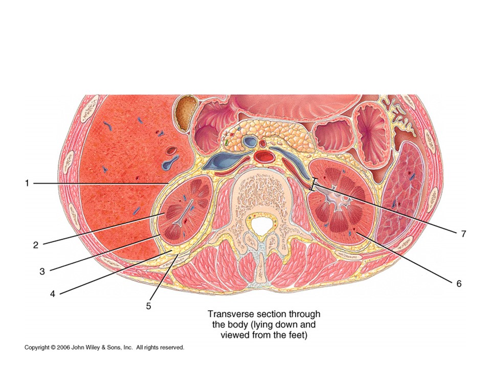 <p>Locate the renal capsule</p>