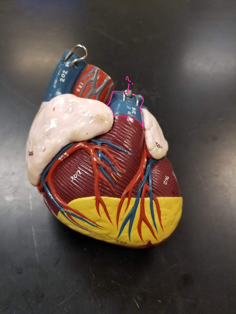 <p>what is outlined in pink? (<span><span>carries blood from the right ventricle to the lungs)</span></span></p>