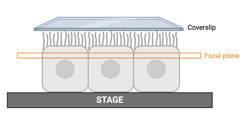 <p><span>The following cell preparation was co-stained with DAPI (stains nuclei blue) and a red dye that labels cilia. You properly mount the cells on a compound microscope using a high-power objective and move the specimen to the middle of the focal plane (indicated by the orange box).</span></p><p>&nbsp;</p><p></p><p>By&nbsp;<strong>raising&nbsp;</strong>the stage slowly,&nbsp;</p><p>&nbsp;</p><p>blue structures will appear, and you would never see red structures</p><p>blue structures will appear, and then you would see red structures&nbsp;</p><p>Red structures will appear, and then you would never see blue structures&nbsp;</p><p>Red structures will appear, and then you would see blue structures</p><p>Neither red or blue structures would appear.</p>