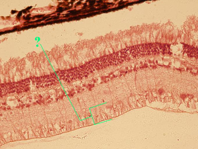 <p><span><span>Identify the indicated layer of the retina</span></span></p>