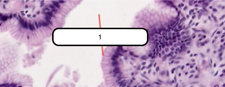 <p>In this slide, identify the structure labeled as #1</p>