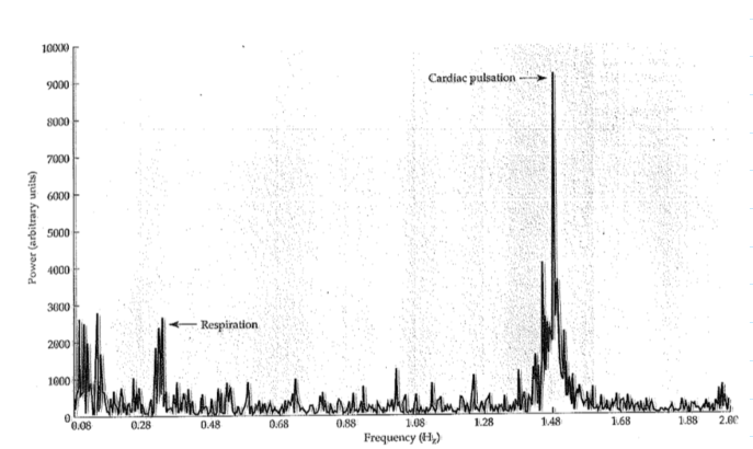 <p>If TR = 2 sec, looking at the spectral analysis, which peaks will alias?</p>