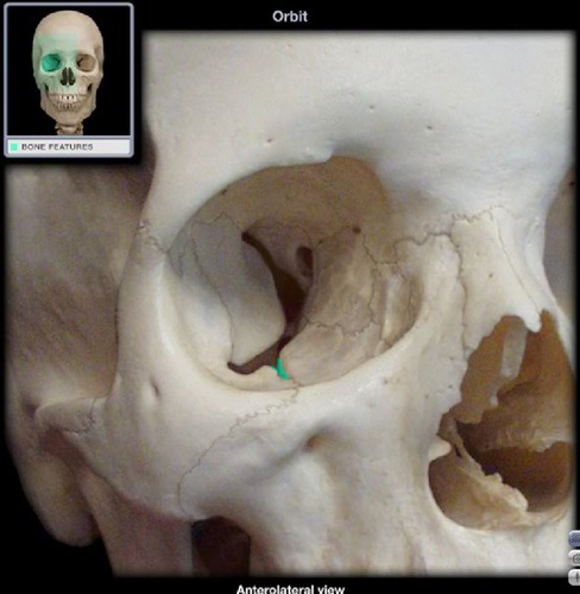 <p>centered on the posterior half of the orbital floor and opens posterosuperiorly, connects anteroinferiorly with the infraorbital foramen via infraorbital canal</p>