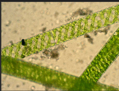 <p>spirogyra</p>