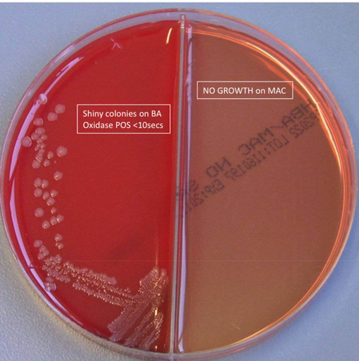 <p>GNB, oxidase pos, spot indole pos, NG on MAC, catalase pos</p>