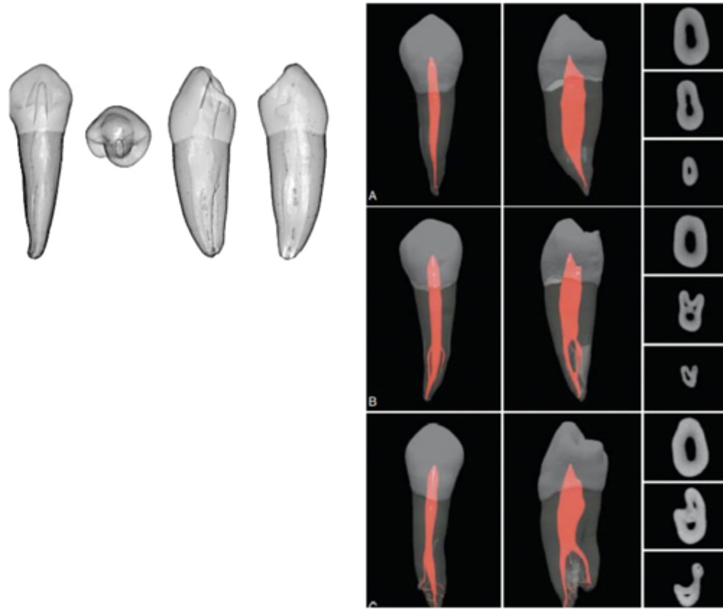 <p>mandibular 1st PM</p>