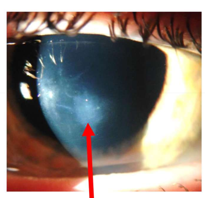 <p>Name the finding.</p>