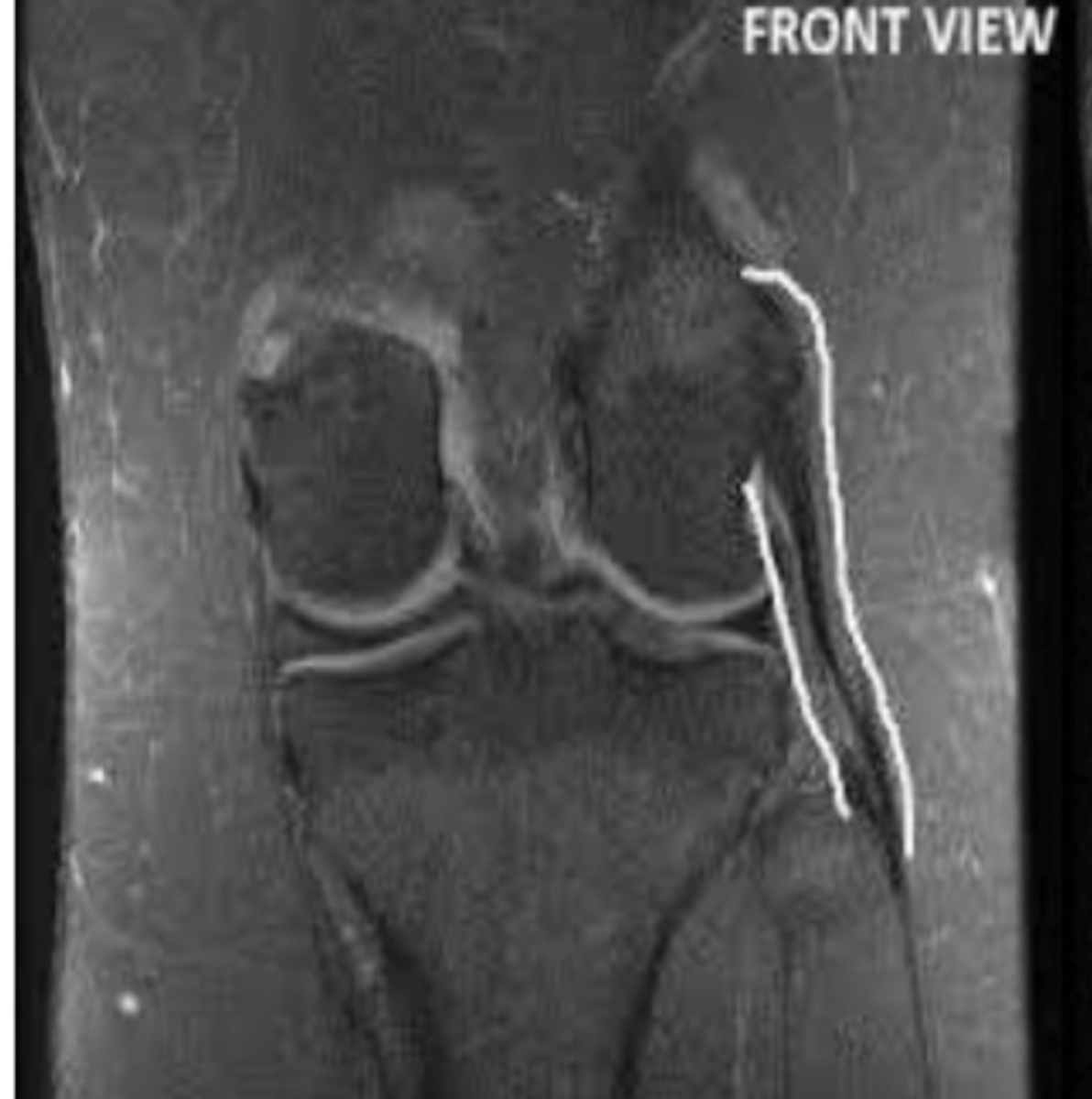 <p>Define the pathology.</p>