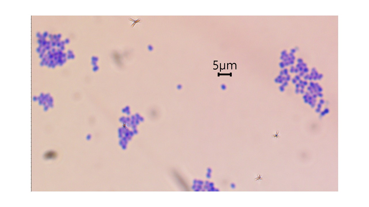 <p>w<span>hich type of cell wall (Gram negative or Gram positive) was Stahylococcus epidermidis</span></p>