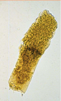 <p>What type of cast is pictured?</p>
