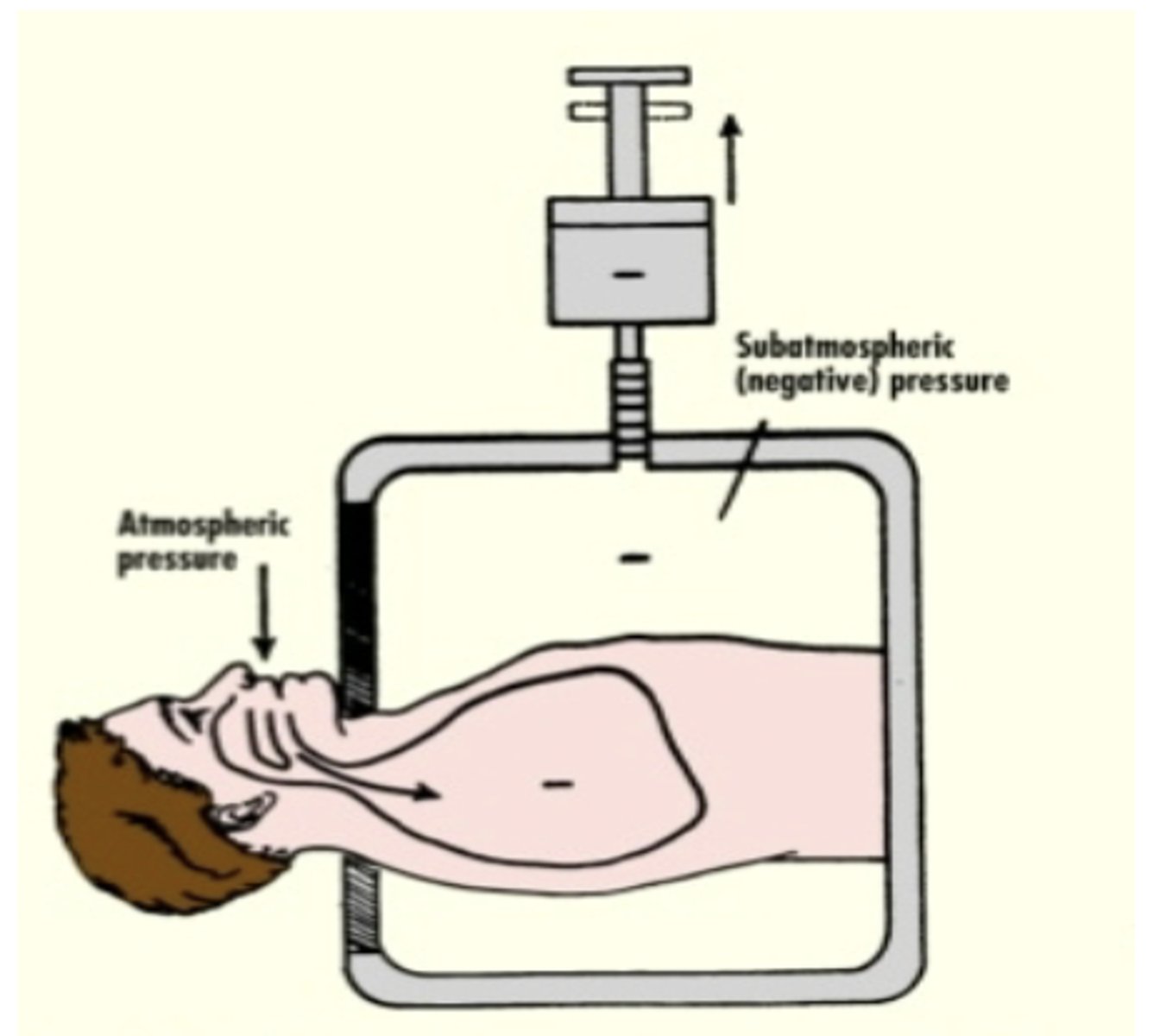 <p>-Ventilation of the lungs by expanding the rib cage to "pull" air into the lungs</p><p>-ex: iron lung, cuirass ventilation</p>