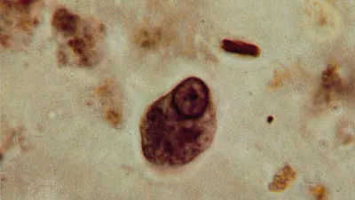 <p>Entamoeba hartmanni</p><p>Troph=8-10 um</p><p>Cyst= 6-8 um</p>