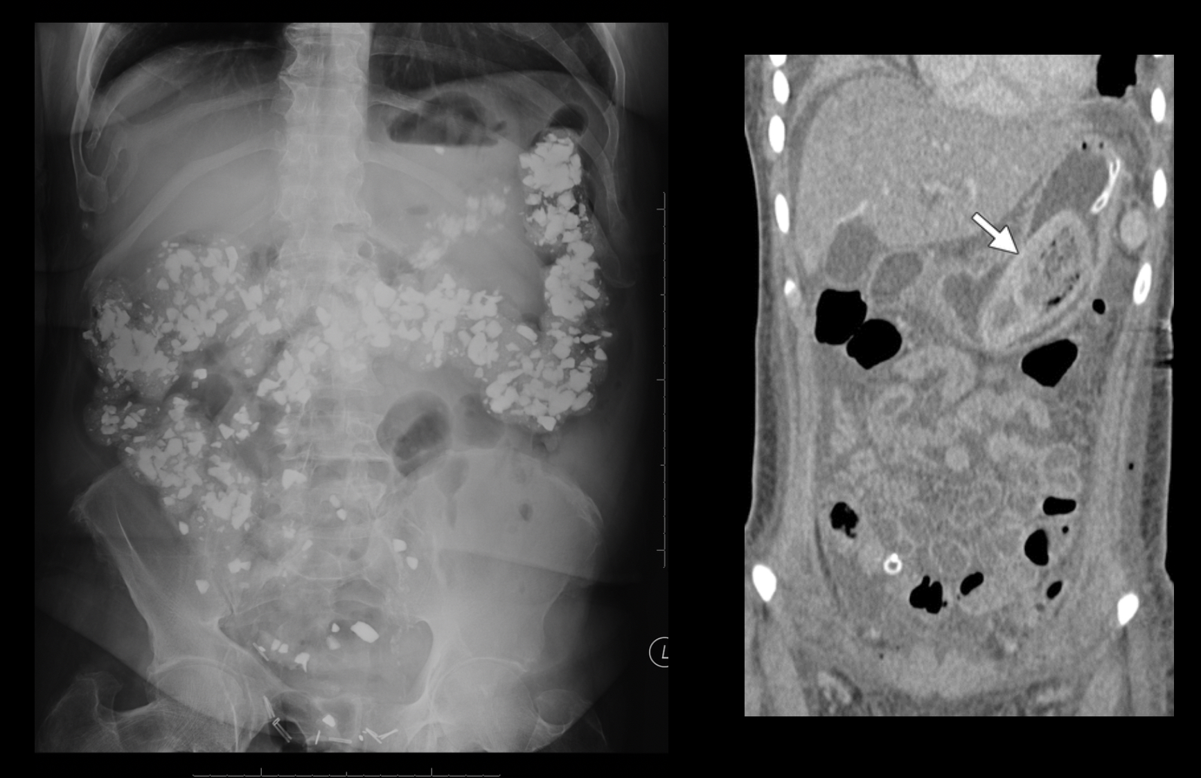 <p>What pathology is this?</p>