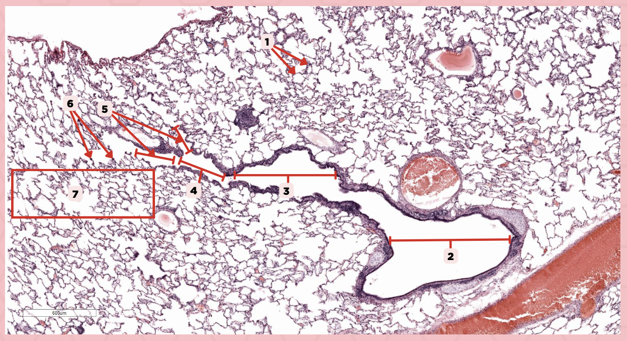<p>Identify the structure labeled as 7.</p>