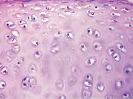 <p>A type of cartilage characterized by a glossy, smooth appearance, found in joints and respiratory structures.</p>