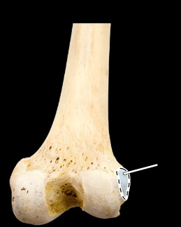 <p>Femur, posterior view, right side, distal end</p>