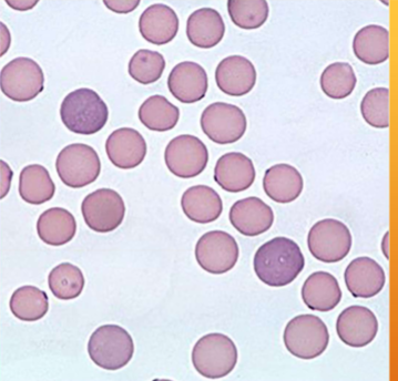 <p>what does&nbsp;<span style="color: rgb(255, 255, 255);"><span>Mycoplasma haemofelis cause&nbsp;</span></span></p>