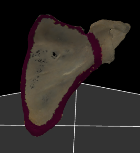 <p>volledige voorzijde van scapula</p>