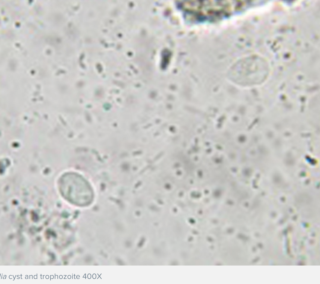 <p>test dogs with a combo of:</p><p>-fecal wet mount (falling lead motility)</p><p>-fecal flotation with centrifugation</p><p>-fecal ELISA/IFA</p>