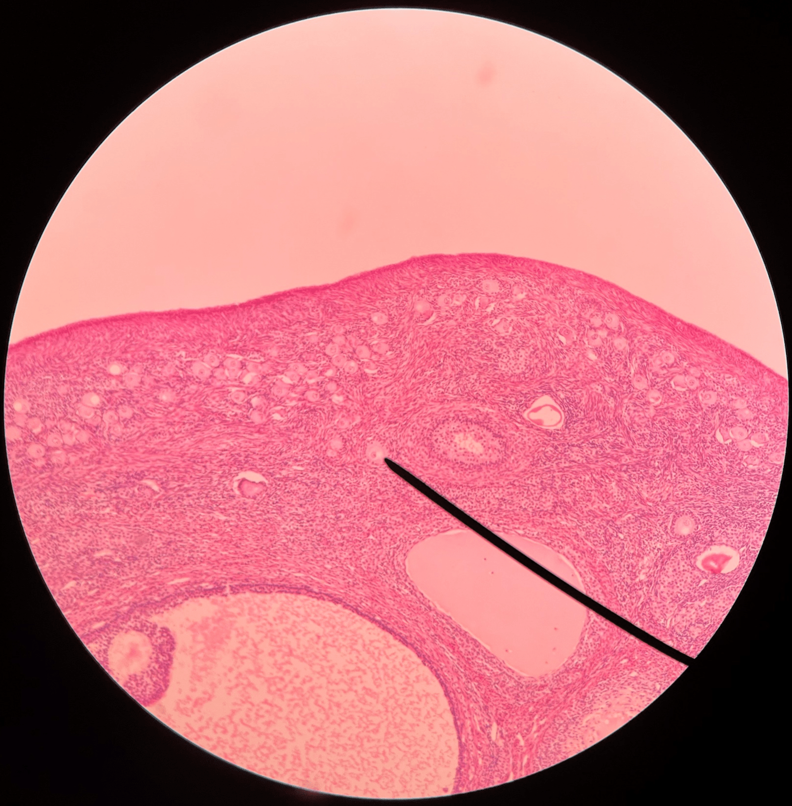 • Slide histology of the ovary.

• Appears slightly larger than a primordial follice with a distinguished boundary.