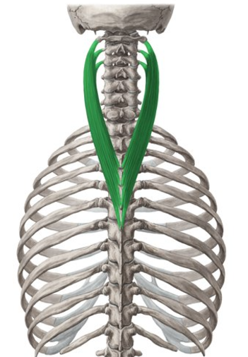 <p>Splenius cervicis insertion</p>