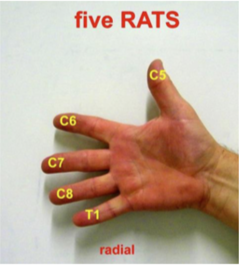 <p>C5-T1</p>