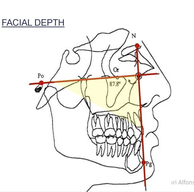 <p>Angle between<strong> Facial plane </strong>and<strong> Frankfort plane</strong></p><p class="has-focus"></p><p class="has-focus"><strong>Higher -</strong> <strong>Mandibular protrusion</strong></p><p class="has-focus"><strong>Lower - Mandibular retrusion</strong></p>