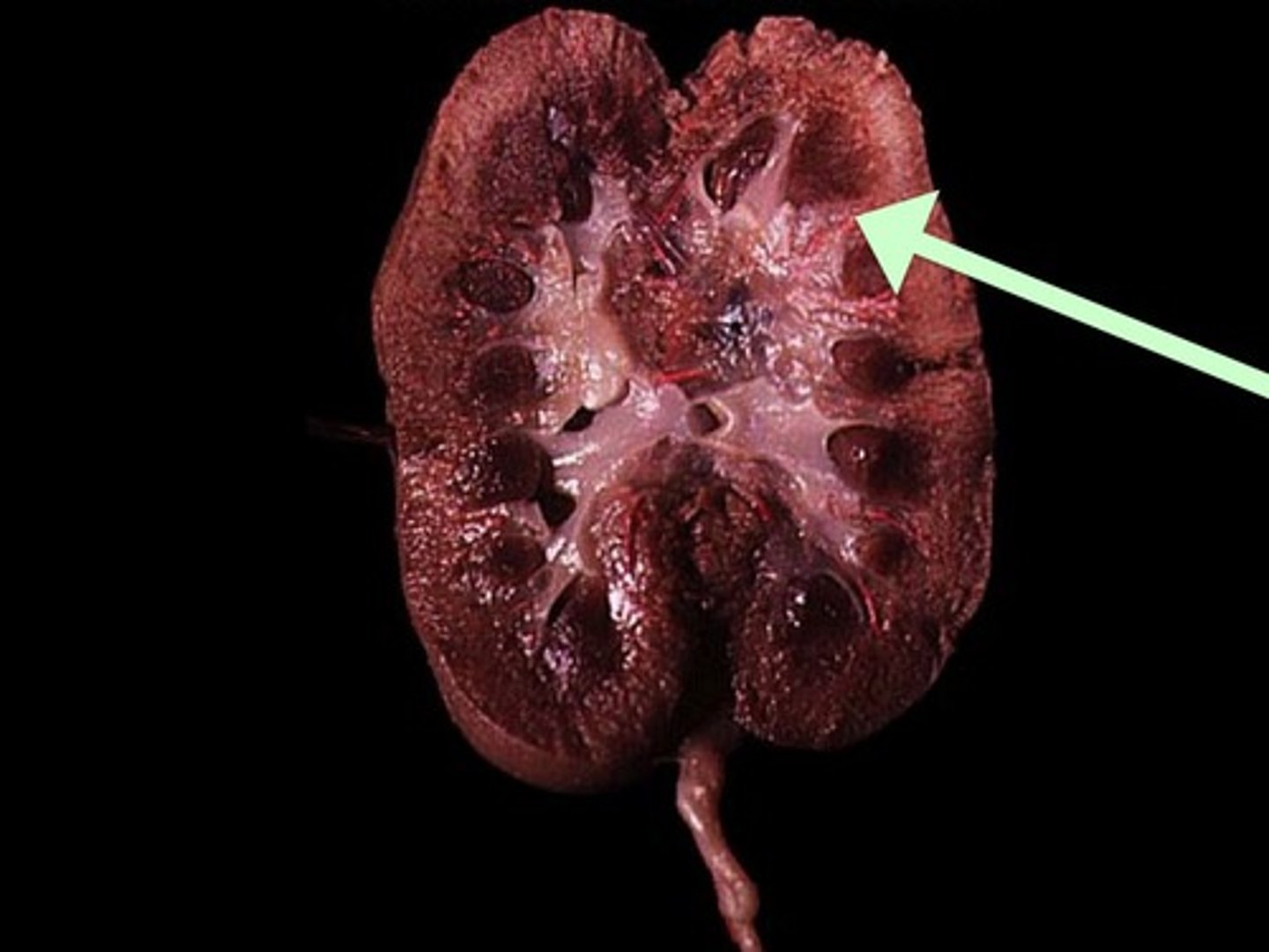 <p>Inward extensions of the cortex tissue separating the renal pyramids.</p>