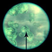 -the view when you look down a microscope, and what is observed within the circle