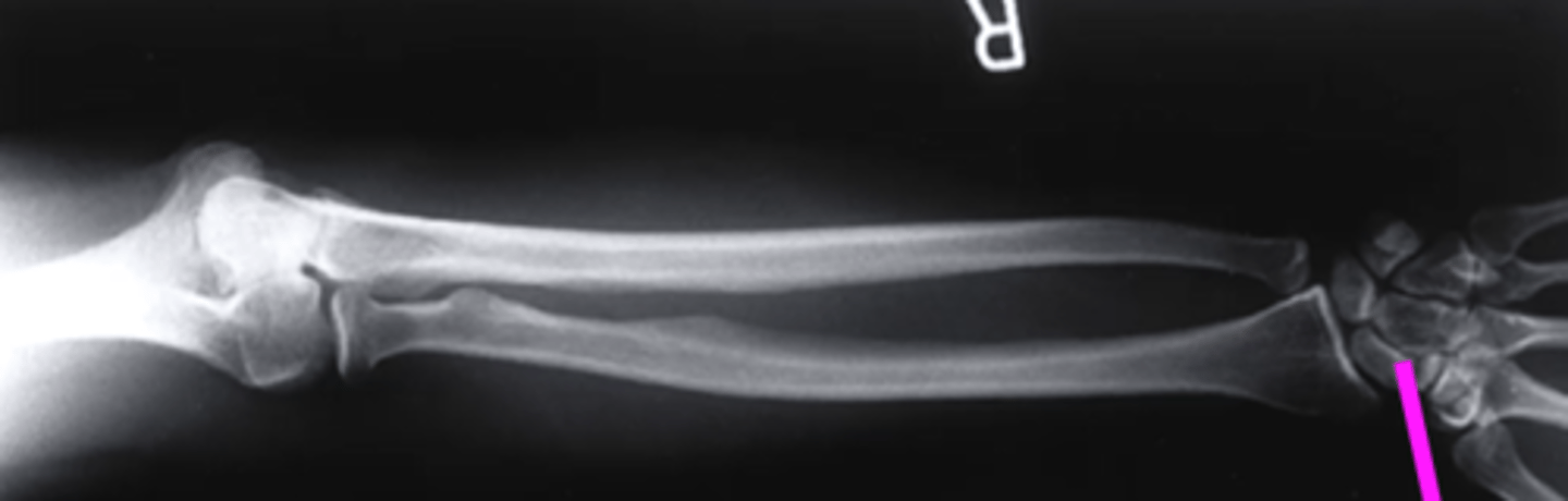 <p>what does this pink line point to?</p>