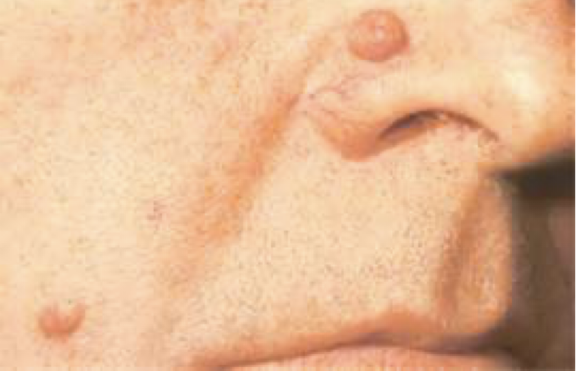 term image