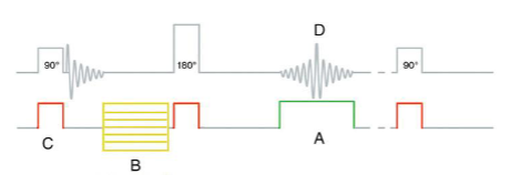 <p><span><span>What is “D”?</span></span></p>