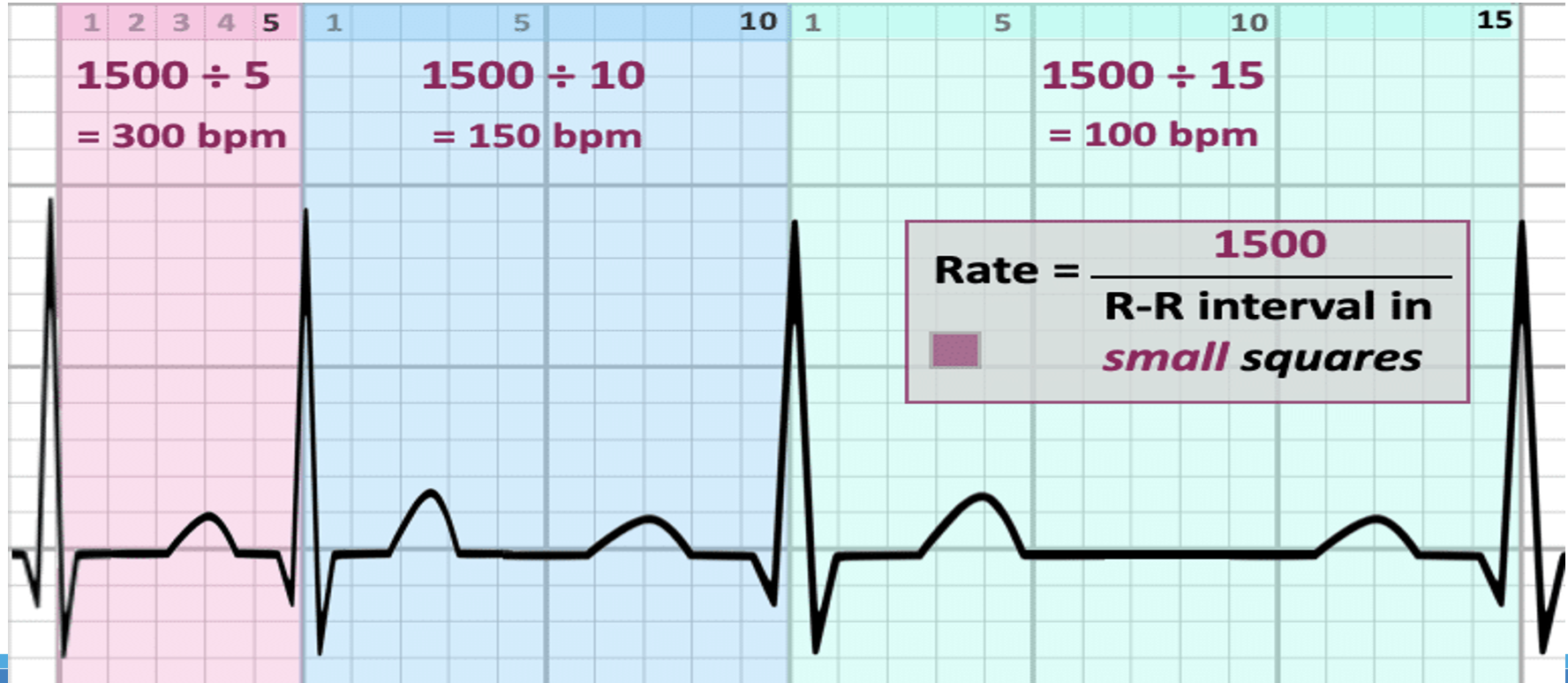 <p>EKG Basics: How to determine a heart rate? </p>